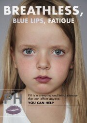 Donate - Breathless, blue lips, fatigue